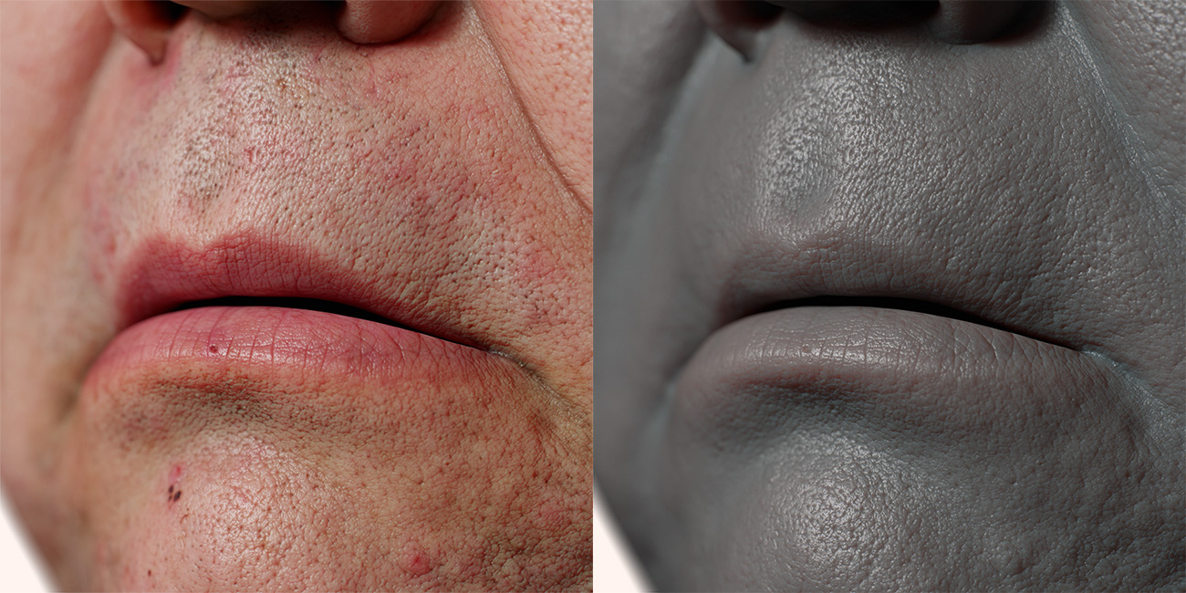 Male head scan skin pore details 